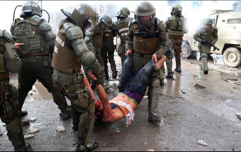 Image result for imagenes de los heridos en chile"