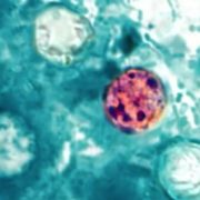 Salud descarta brote de Cyclospora en el país 10 01 11