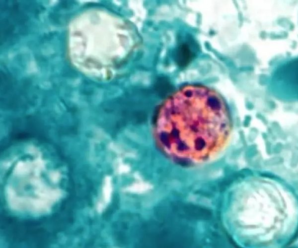 Salud descarta brote de Cyclospora en el país 5 01 11