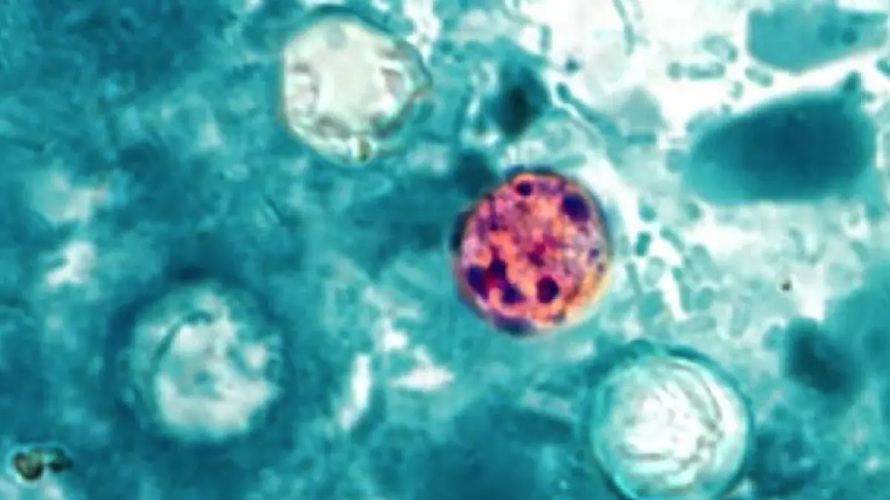 Salud descarta brote de Cyclospora en el país 4 01 11
