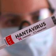 Chile declara alerta sanitaria preventiva por aumento de casos de hantavirus 9 08 18