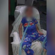 Instituciones de salud, sin recursos para el cuidado de menores con traqueotomía, advierte A.C. 9 Poky01AngelesGuerreros