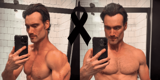 Los peligros del perfeccionismo estético digital: la muerte de Connor Murphy interpela a la industria del biohacking 3 featured 10